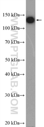 HTATSF1 Antibody in Western Blot (WB)