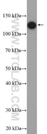 HTATSF1 Antibody in Western Blot (WB)