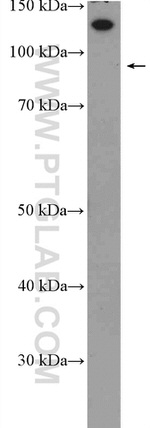 HTATSF1 Antibody in Western Blot (WB)