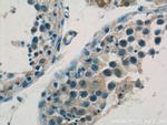 DAX-1 Antibody in Immunohistochemistry (Paraffin) (IHC (P))