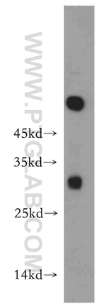 THAP2 Antibody in Western Blot (WB)