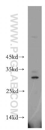 THAP2 Antibody in Western Blot (WB)