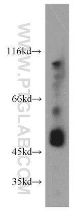 GABPB2 Antibody in Western Blot (WB)