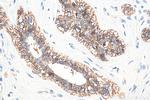 E-cadherin Antibody in Immunohistochemistry (Paraffin) (IHC (P))