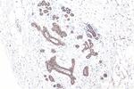 E-cadherin Antibody in Immunohistochemistry (Paraffin) (IHC (P))