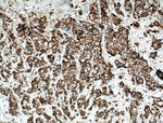 E-cadherin Antibody in Immunohistochemistry (Paraffin) (IHC (P))