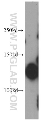 E-cadherin Antibody in Western Blot (WB)