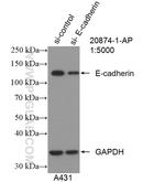 E-cadherin Antibody in Western Blot (WB)