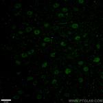 TBR1 Antibody in Immunohistochemistry (PFA fixed) (IHC (PFA))