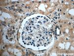 ZC3HAV1L Antibody in Immunohistochemistry (Paraffin) (IHC (P))