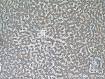 INSC Antibody in Immunohistochemistry (Paraffin) (IHC (P))