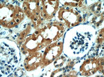 Raptor Antibody in Immunohistochemistry (Paraffin) (IHC (P))