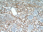 Raptor Antibody in Immunohistochemistry (Paraffin) (IHC (P))