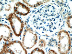 Raptor Antibody in Immunohistochemistry (Paraffin) (IHC (P))