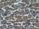 ULK1 Antibody in Immunohistochemistry (Paraffin) (IHC (P))