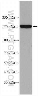 ULK1 Antibody in Western Blot (WB)