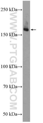 ULK1 Antibody in Western Blot (WB)