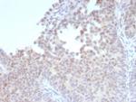 ER-beta (Estrogen Receptor beta-1) Antibody in Immunohistochemistry (Paraffin) (IHC (P))