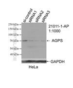 Alkyl-DHAP synthase/AGPS Antibody in Western Blot (WB)