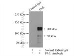 PML Antibody in Immunoprecipitation (IP)