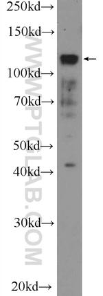 PML Antibody in Western Blot (WB)