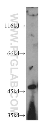 NR1I3 Antibody in Western Blot (WB)
