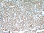 UBXD2 Antibody in Immunohistochemistry (Paraffin) (IHC (P))