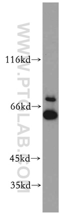 UBXD2 Antibody in Western Blot (WB)