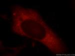 Synaptopodin Antibody in Immunocytochemistry (ICC/IF)