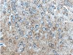 Synaptopodin Antibody in Immunohistochemistry (Paraffin) (IHC (P))