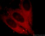 Synaptopodin Antibody in Immunocytochemistry (ICC/IF)