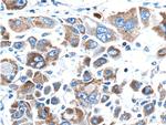 MEKK3 Antibody in Immunohistochemistry (Paraffin) (IHC (P))