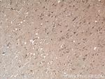 AFAP1 Antibody in Immunohistochemistry (Paraffin) (IHC (P))