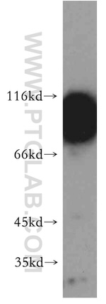 AFAP1 Antibody in Western Blot (WB)