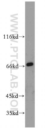 RANBP10 Antibody in Western Blot (WB)