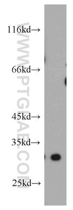 DKK1 Antibody in Western Blot (WB)