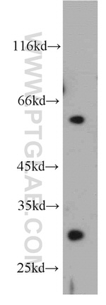 DKK1 Antibody in Western Blot (WB)