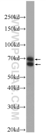 BBS1 Antibody in Western Blot (WB)