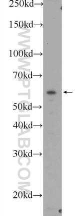 BBS1 Antibody in Western Blot (WB)