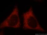 KIR2DS4 Antibody in Immunocytochemistry (ICC/IF)