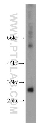 KIR2DS4 Antibody in Western Blot (WB)