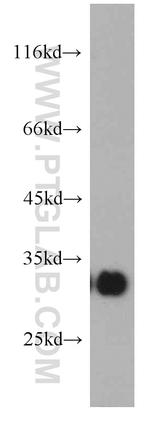 KIR2DS4 Antibody in Western Blot (WB)