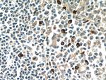 MKL1 Antibody in Immunohistochemistry (Paraffin) (IHC (P))