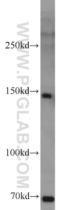 MKL1 Antibody in Western Blot (WB)