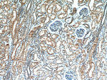 CBLL1 Antibody in Immunohistochemistry (Paraffin) (IHC (P))