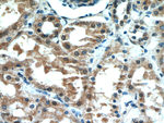 CBLL1 Antibody in Immunohistochemistry (Paraffin) (IHC (P))