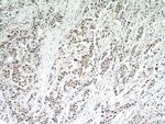 CBLL1 Antibody in Immunohistochemistry (Paraffin) (IHC (P))