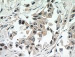 CBLL1 Antibody in Immunohistochemistry (Paraffin) (IHC (P))