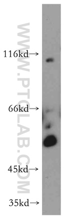 CBLL1 Antibody in Western Blot (WB)