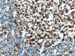 BCL6 Antibody in Immunohistochemistry (Paraffin) (IHC (P))